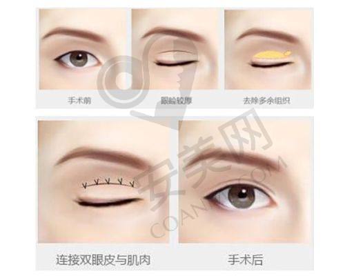 二级医院的广州艺星医疗美容医院有哪些优势？