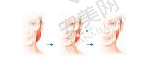 北京XX整形医院：独特技术受追捧