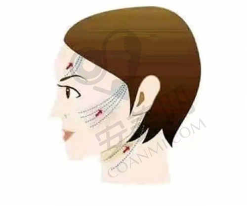小耳症患者在治疗前后需要注意什么？
