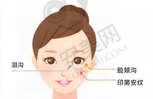 哪些人适合广州艺星腰腹吸脂？