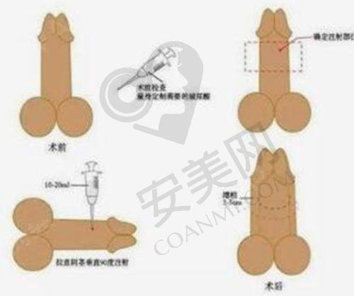 北京卓彦丽格赵琼医生怎么样？