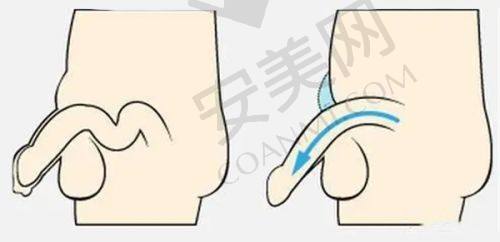 成都八大处医院的小耳症治疗实例有哪些？