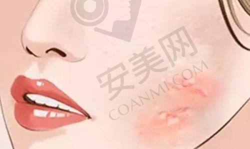 广州艺星医疗美容医院到底是几级医院？