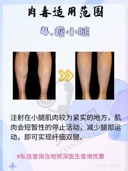 济南诺德陈三群医生鼻整形技修复怎么样？