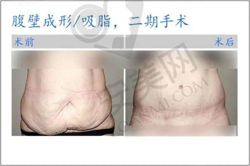 价格收费情况分析，合肥华美和艺星谁的性价比更高？