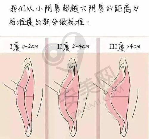 广州雪儿海蒂私密李宁辉医生简介