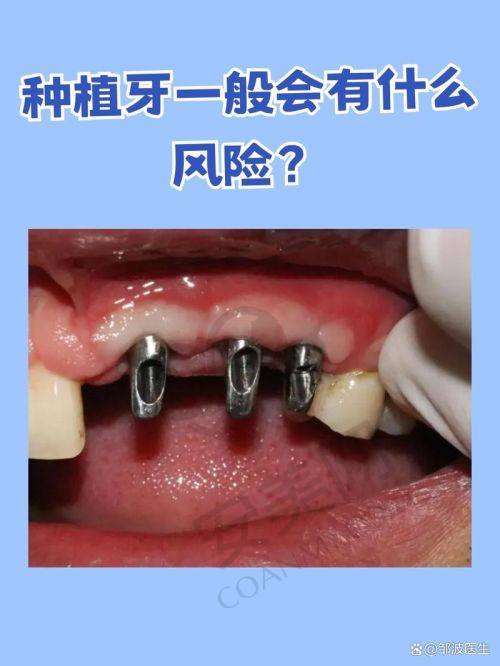 珠海九龙口腔储志强医生擅长项目