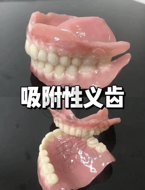与其他义齿相比，BPS吸附性义齿有哪些优势？