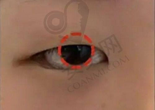 总结：北京碧莲盛不剃发植发值得选择吗？