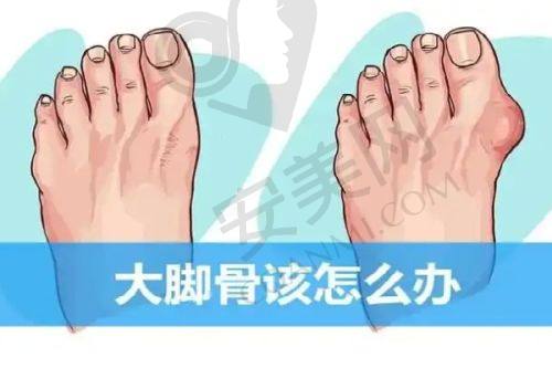 成都美容整形医院双眼皮整形有哪些技术优势？