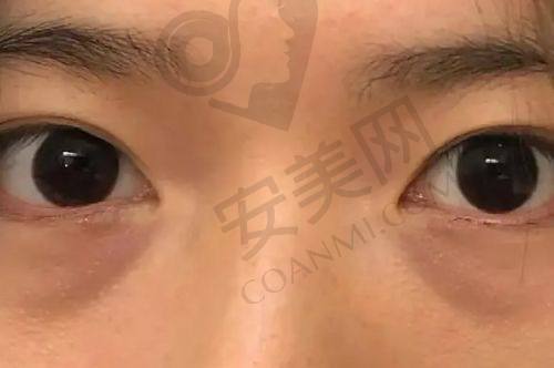 顾客对武汉五洲医院打造幼态脸的评价如何？