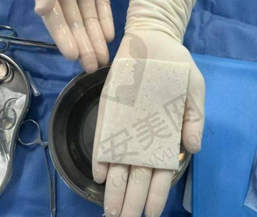 武汉五洲整形医院在行业内的口碑怎样？