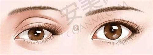 v美减龄v9治疗过程是怎样的？