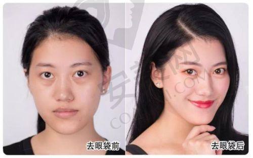 武汉五洲整形医院的技术能满足不同需求吗？
