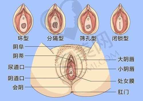 足外翻大脚骨的相关知识