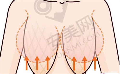 北京加减美v美拉皮价格与成效是否成正比？