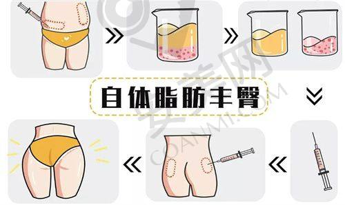 为何禾美整形在双眼皮修复上备受瞩目