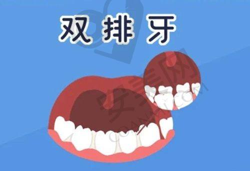 哈尔滨美植口腔牙齿瓷贴面美白1680元起是真的吗？