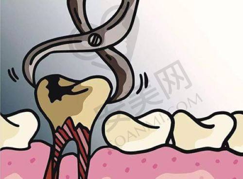 榆林德系口腔医院牙齿根管治疗的特色是什么？
