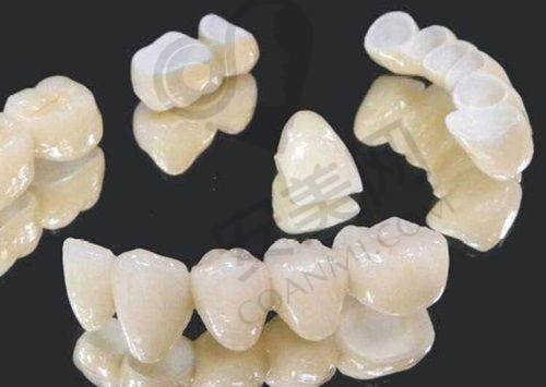 宜昌中汉口腔使用德国BEGO钴铬的技术水平如何？