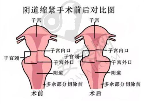 总结