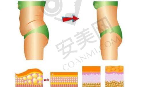 医生会根据我的情况制定方案吗？