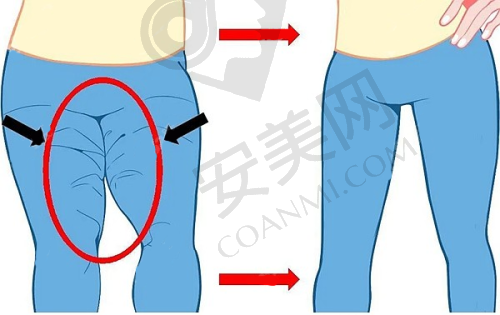 如何综合判断成都艾米丽整形医院是否正规？