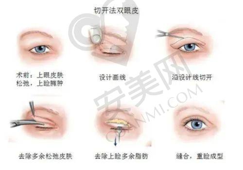 北京碧莲盛植发医院的环境可靠吗？