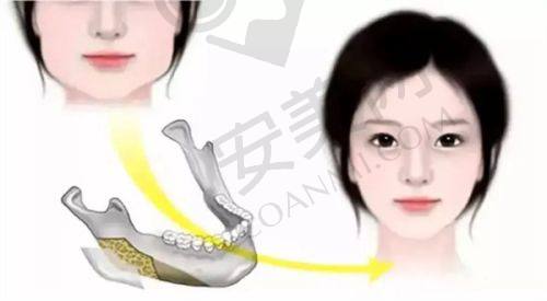消费者在选择成都美容整形医院时应注意什么？