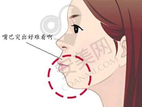 如何选择适合自己的双眼皮整形方式？