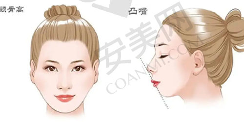 3. 华美聂婕医生幼态脸打造怎么样？