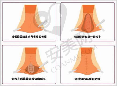 从术前评估到术后全流程服务