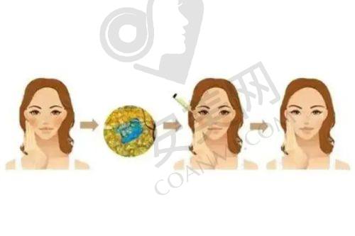 成都美容整形医院如何应对避雷说法？