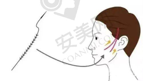 v美减龄v9项目有哪些注意事项？