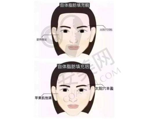 总结
