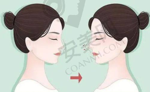 上海BR复塑美学中 心的优势体现在哪里？
