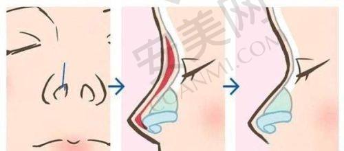 厦门祛斑收费价格明细参考