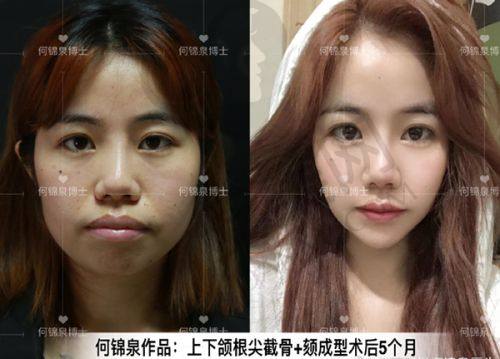 总结