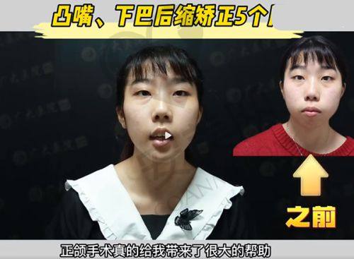 5、长春娅秘珠刘颖医生患者评价