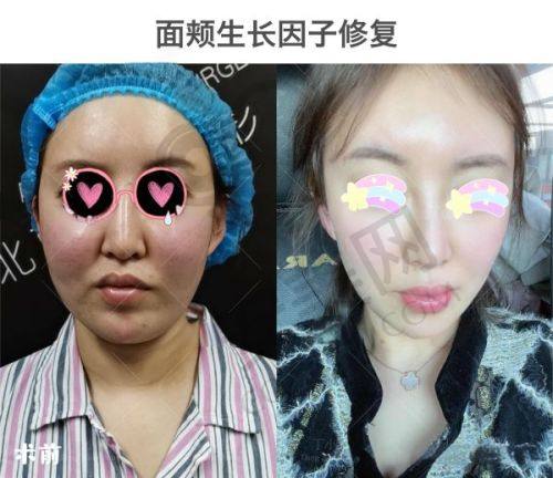 五、长沙月倾医疗美容诊所预约挂号流程：