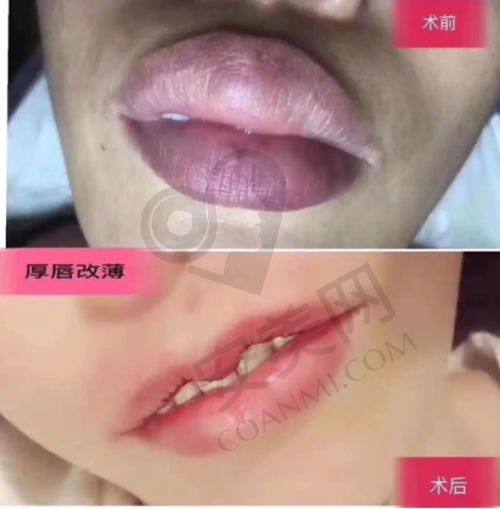 上海华美医疗美容医院的口碑和信誉如何？