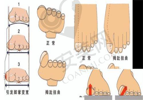 西安艺星眼综合手术的优势在哪里？