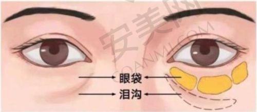 上海华美打玻尿酸塑轮廓，有什么特色？
