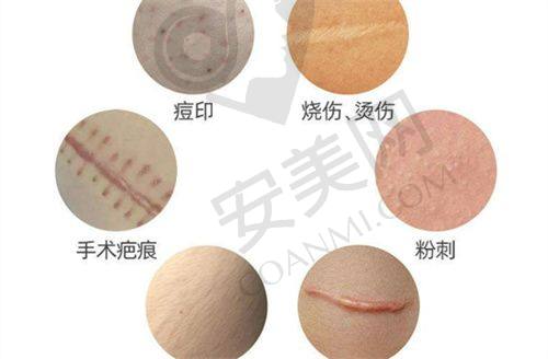 预约电话的优势有哪些？