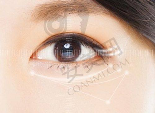 北京紫洁与其他去眼袋方法相比，不开刀去眼袋可靠吗？