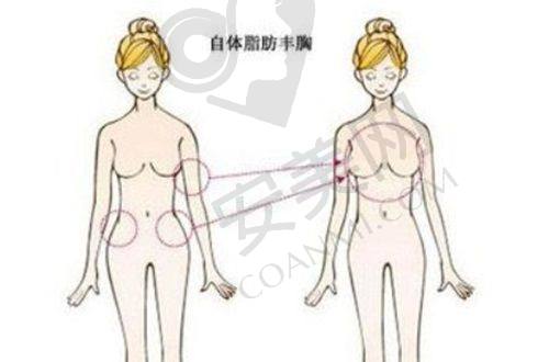深入了解人中缩短术