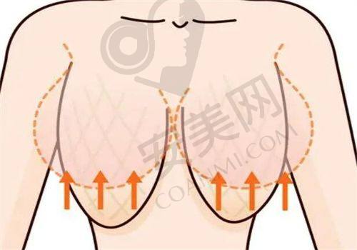 正颌手术价格