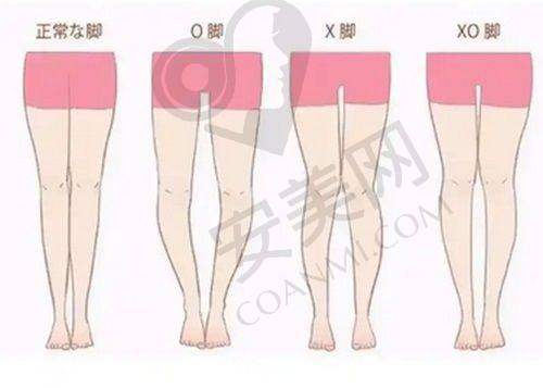 北京加减美拉皮手术的技术实力如何？