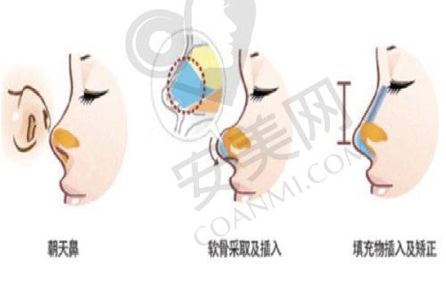 北京知音李磊医生怎么样