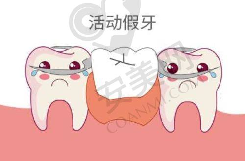 半口种植牙是什么？